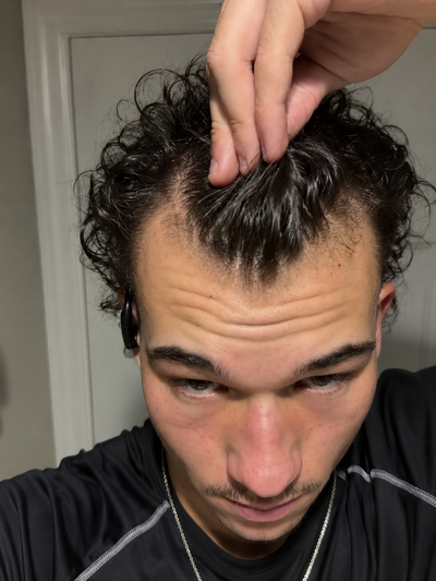 Before