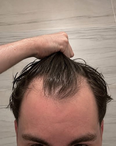 Before