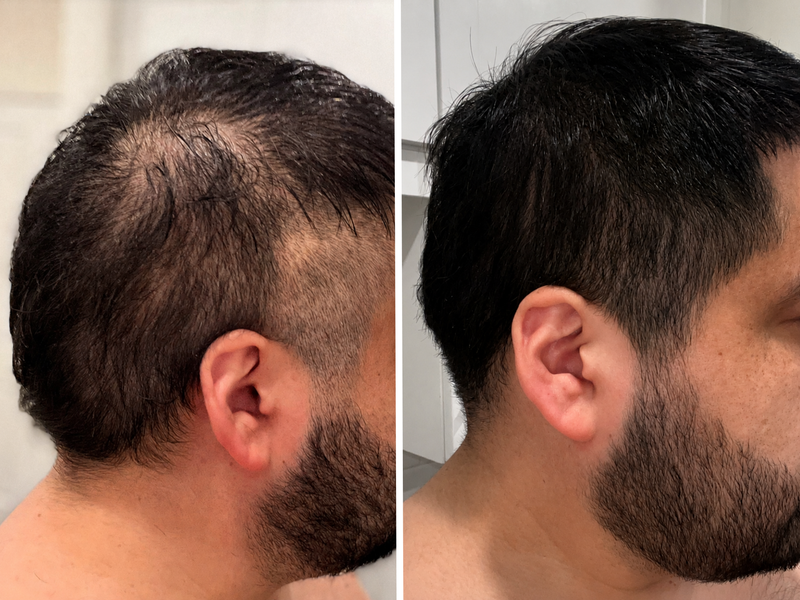 GROW Scalp Serum™